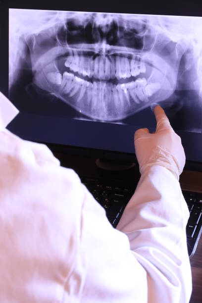 Best Emergency Tooth Extraction in Lmar, DE